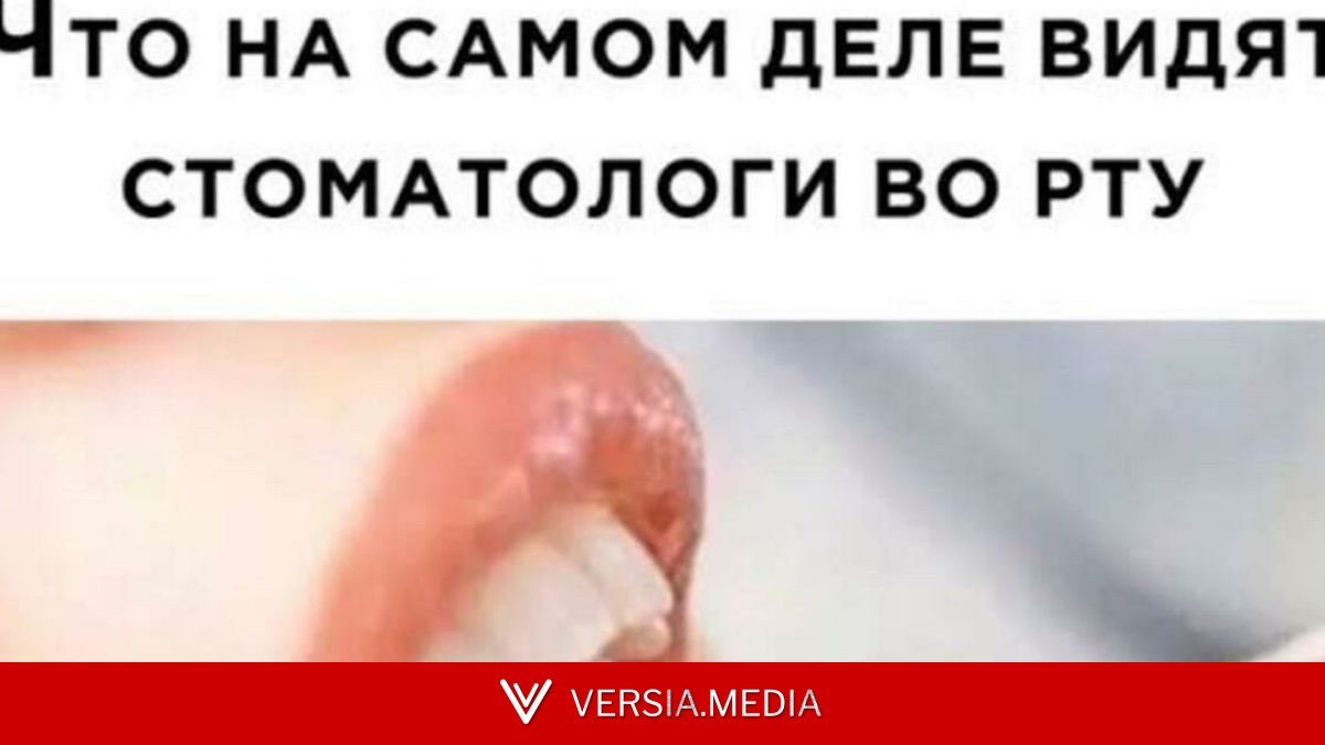 Откройте рот и кошелек пошире: 10 мемов про стоматологию и зубы