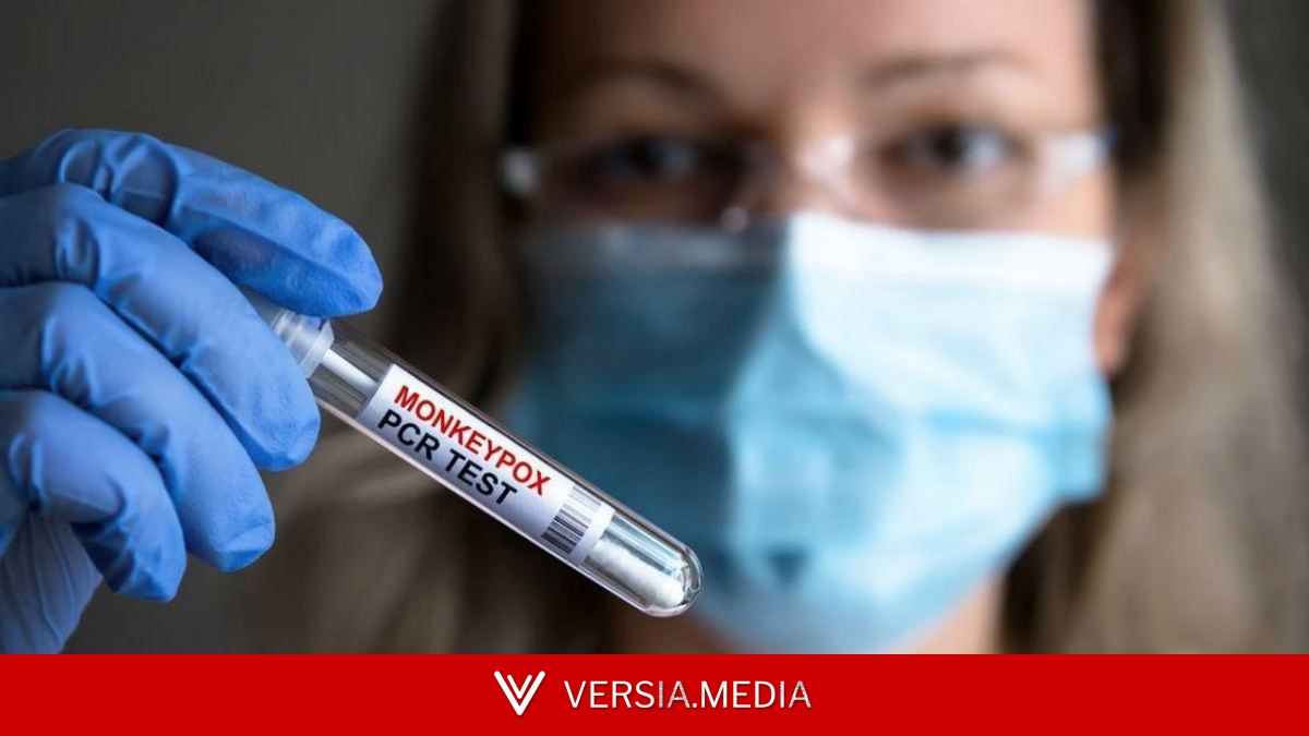 Что известно о состоянии здоровья пяти человек из Подмосковья, у которых подозревают оспу обезьян